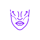 midface-filler